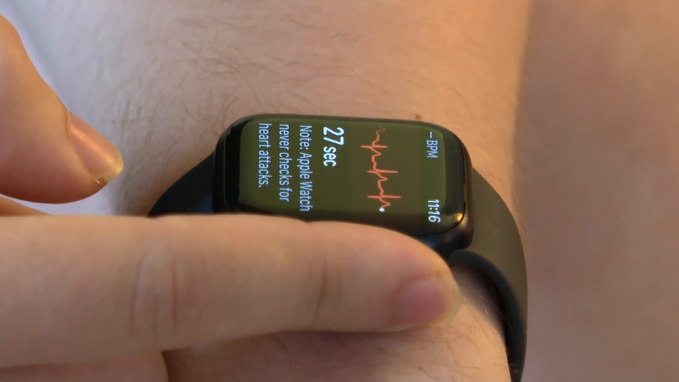 Man credits smartwatch for helping him detect heart issue