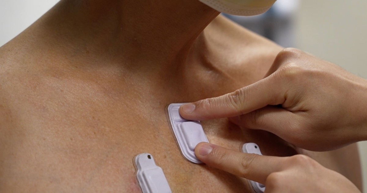 First-of-their-kind wearables capture body sounds to continuously monitor health