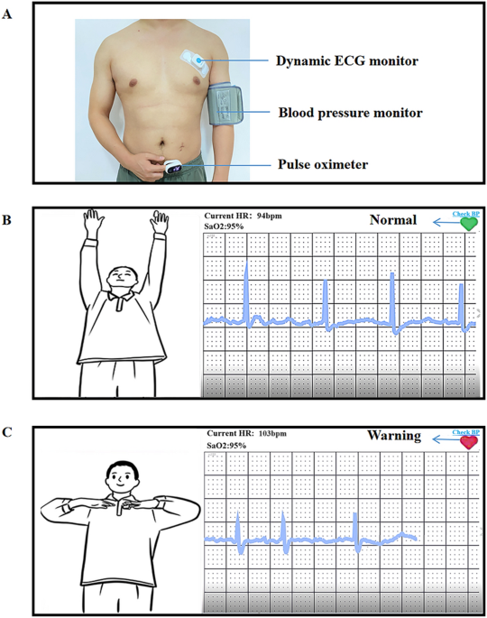Cardiac telerehabilitation under 5G internet of things monitoring: a randomized pilot study