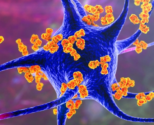 Forever Chemicals Linked to Multiple Sclerosis in Concerning New Study : ScienceAlert