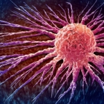 Toxin Stops Colon Cancer Growth, Without Harming Healthy Tissue