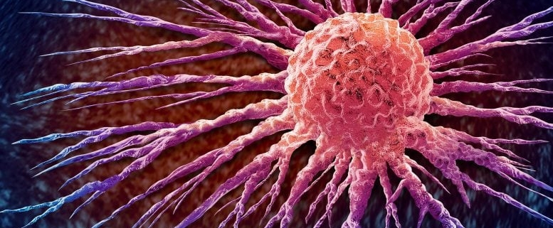 Toxin Stops Colon Cancer Growth, Without Harming Healthy Tissue