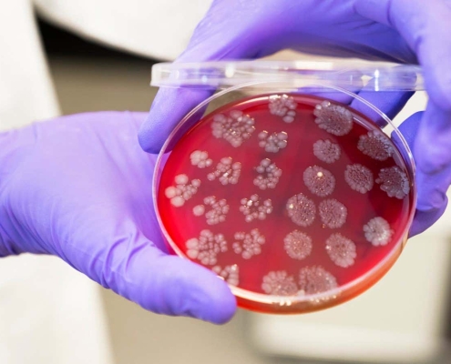 Faecal transplants could boost the effectiveness of cancer treatments