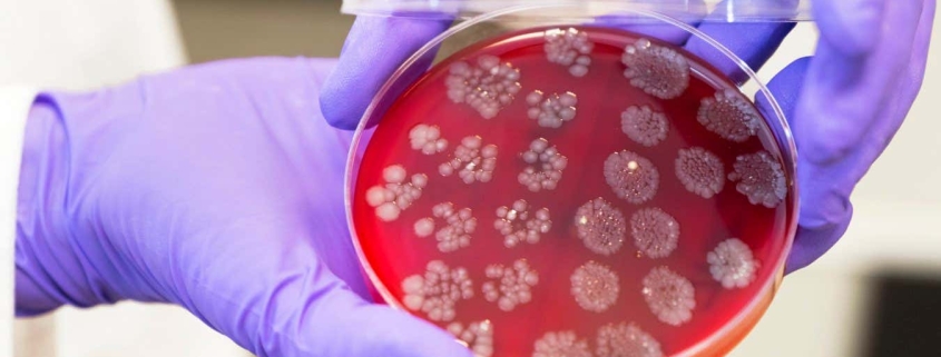 Faecal transplants could boost the effectiveness of cancer treatments