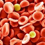 Scientists Identified a New Blood Group After 50-Year Mystery : ScienceAlert