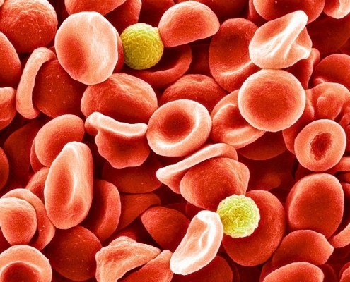 Scientists Identified a New Blood Group After 50-Year Mystery : ScienceAlert