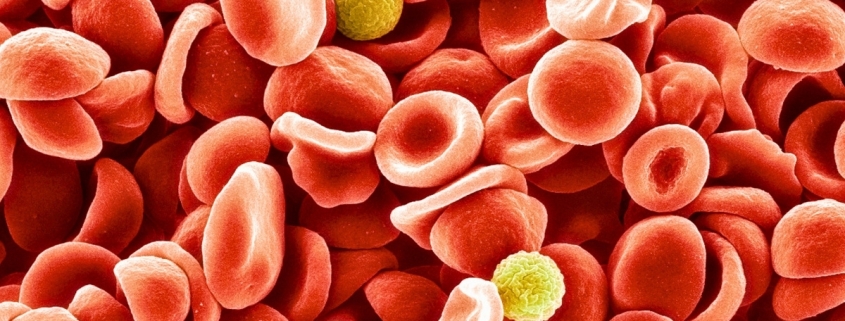 Scientists Identified a New Blood Group After 50-Year Mystery : ScienceAlert