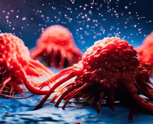 Cancer May Emit Signals That Protect The Brain Against Alzheimer’s : ScienceAlert