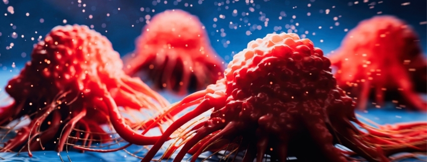 Cancer May Emit Signals That Protect The Brain Against Alzheimer’s : ScienceAlert