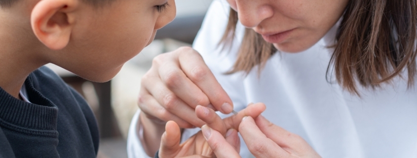 What to Do (And Not Do) When You Have a Splinter : ScienceAlert