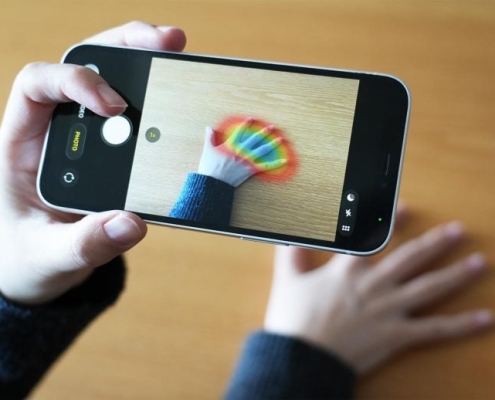 AI Finds Life Shortening Hormone Disorder Using Only Hand Photos