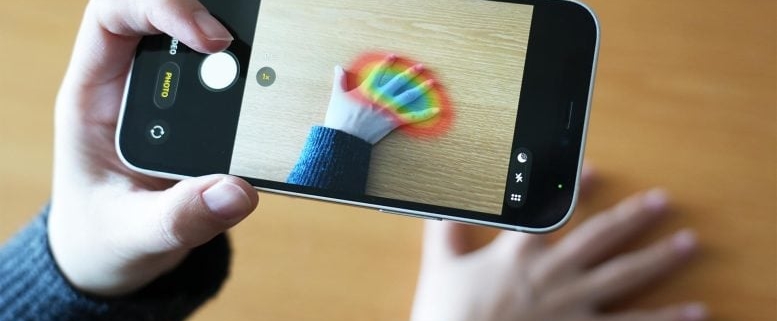 AI Finds Life Shortening Hormone Disorder Using Only Hand Photos