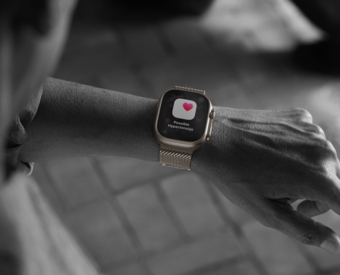 How reliable are Apple Watch Hypertension Notifications?