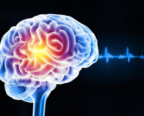 Sleep Deprivation Triggers a Strange Brain Cleanup