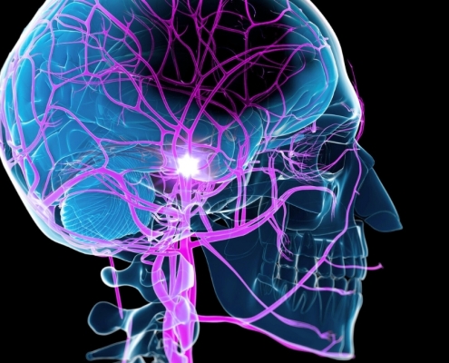 Study Reveals an Unexpected Way to Boost Recovery After a Stroke : ScienceAlert