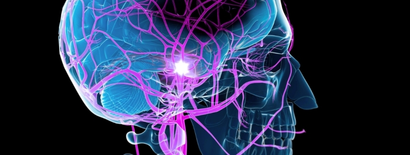 Study Reveals an Unexpected Way to Boost Recovery After a Stroke : ScienceAlert