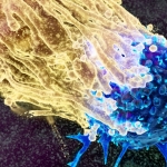 Scientists Want to Intercept Cancer Decades Before It Develops. Here’s How. : ScienceAlert