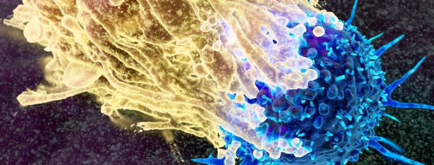 Scientists Want to Intercept Cancer Decades Before It Develops. Here’s How. : ScienceAlert