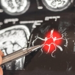 New “Cellular” Target Could Transform How We Treat Alzheimer’s Disease New “Cellular” Target Could Transform How We Treat Alzheimer’s Disease