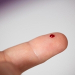 This New Blood Test Can Detect Cancer Before Tumors Appear