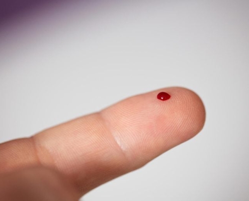 This New Blood Test Can Detect Cancer Before Tumors Appear This New Blood Test Can Detect Cancer Before Tumors Appear