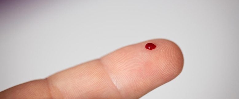 This New Blood Test Can Detect Cancer Before Tumors Appear