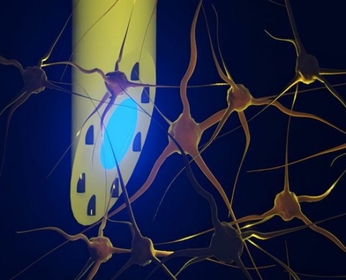 A Needle-Thin Implant Could Transform How Scientists Study and Treat the Brain A Needle-Thin Implant Could Transform How Scientists Study and Treat the Brain