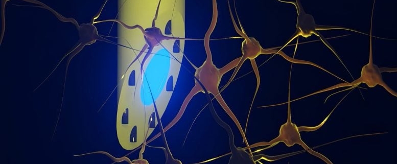 A Needle-Thin Implant Could Transform How Scientists Study and Treat the Brain