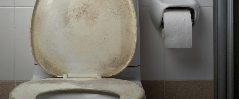 Is Sitting on a Public Toilet Seat Actually Dangerous? The Science Might Surprise You