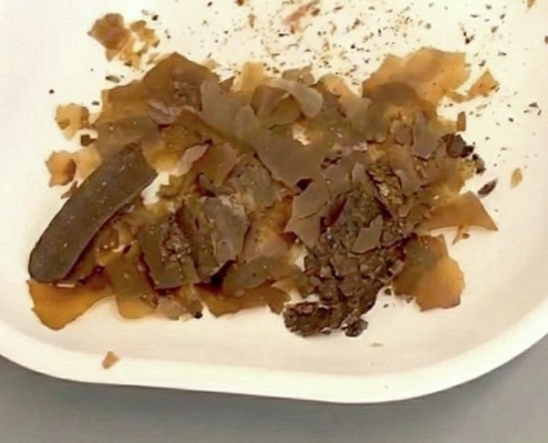 Ancient Romans Really Did Use Poop as Medicine. We Just Got The First Real Proof. : ScienceAlert