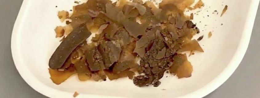 Ancient Romans Really Did Use Poop as Medicine. We Just Got The First Real Proof. : ScienceAlert