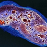 Strips of dried placenta help wounds heal with less scarring