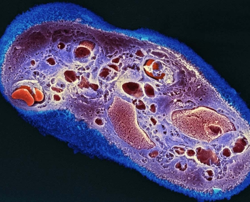 Strips of dried placenta help wounds heal with less scarring