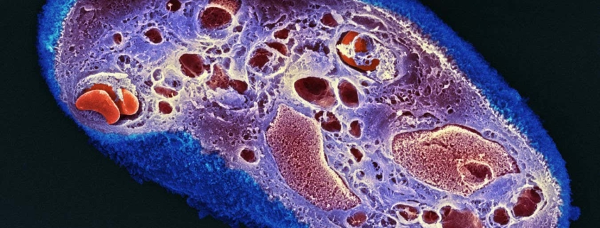 Strips of dried placenta help wounds heal with less scarring