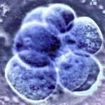 Natural ovulation the best option before an IVF frozen embryo transfer