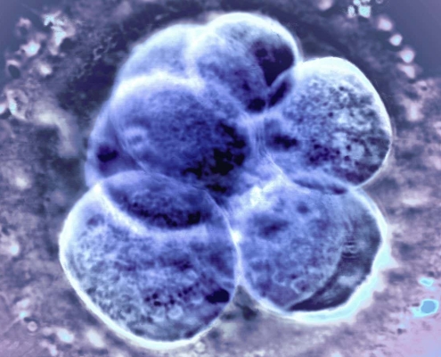 Natural ovulation the best option before an IVF frozen embryo transfer Natural ovulation the best option before an IVF frozen embryo transfer