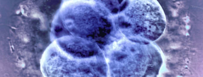 Natural ovulation the best option before an IVF frozen embryo transfer