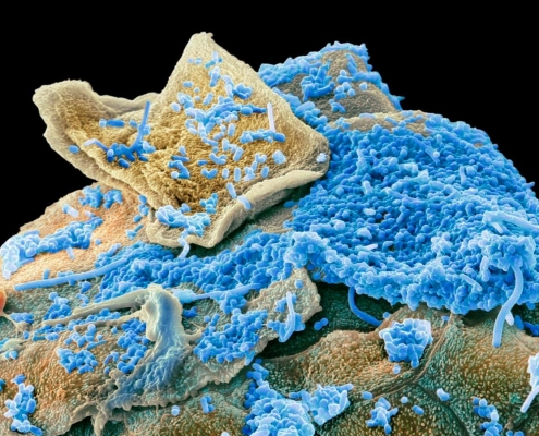 Unusual oral microbiome signature linked to obesity