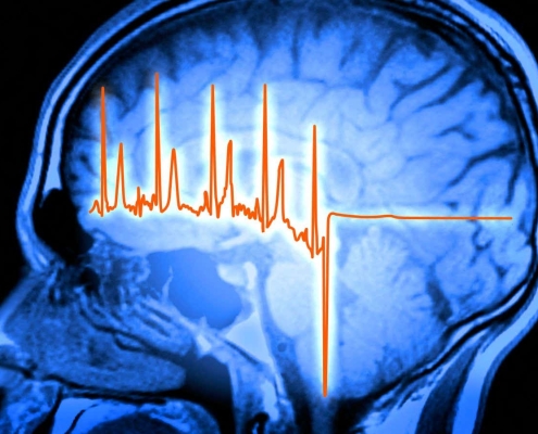 Our brains play a surprising role in recovering from a heart attack