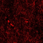 Accidental discovery hints at mystery structures within our brain Accidental discovery hints at mystery structures within our brain