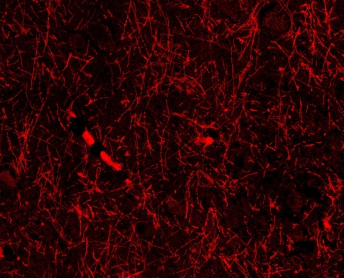 Accidental discovery hints at mystery structures within our brain