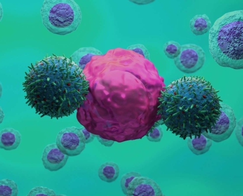 CAR T-cell therapy may slow neurodegenerative conditions like ALS