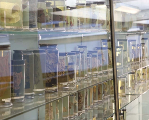 World’s oldest cold virus found in 18th-century woman’s lungs