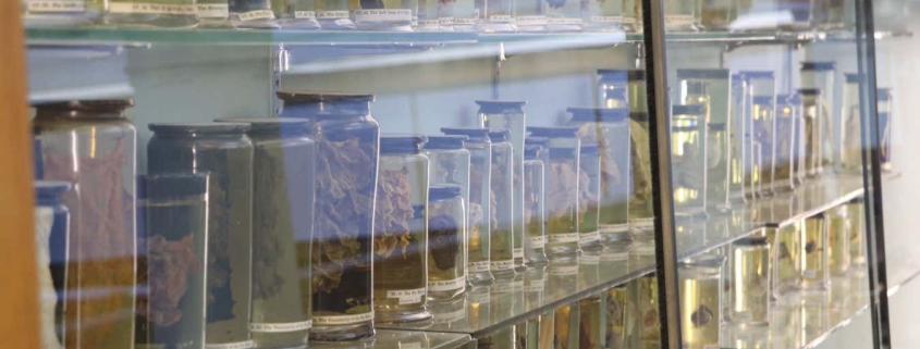 World’s oldest cold virus found in 18th-century woman’s lungs