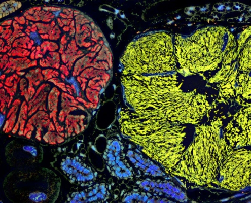 Microbe with the smallest genome yet pushes the boundaries of life