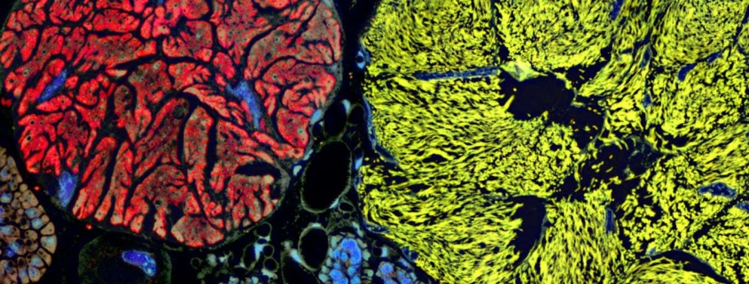 Microbe with the smallest genome yet pushes the boundaries of life Microbe with the smallest genome yet pushes the boundaries of life