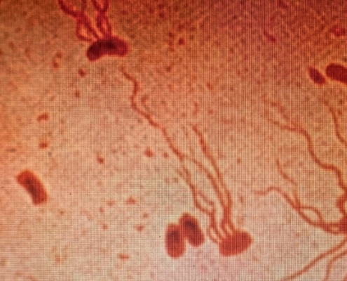 Ancient Killer Is Rapidly Gaining Resistance to Antibiotics, Scientists Warn : ScienceAlert