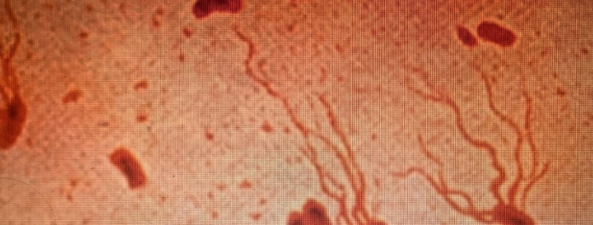 Ancient Killer Is Rapidly Gaining Resistance to Antibiotics, Scientists Warn : ScienceAlert