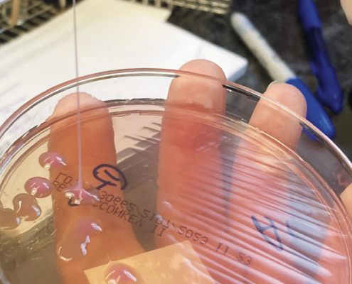 This may be the grossest eye pic ever—but the cause is what’s truly horrifying