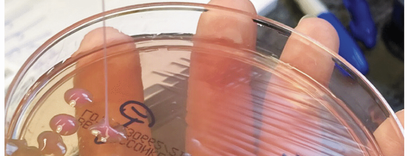 This may be the grossest eye pic ever—but the cause is what’s truly horrifying